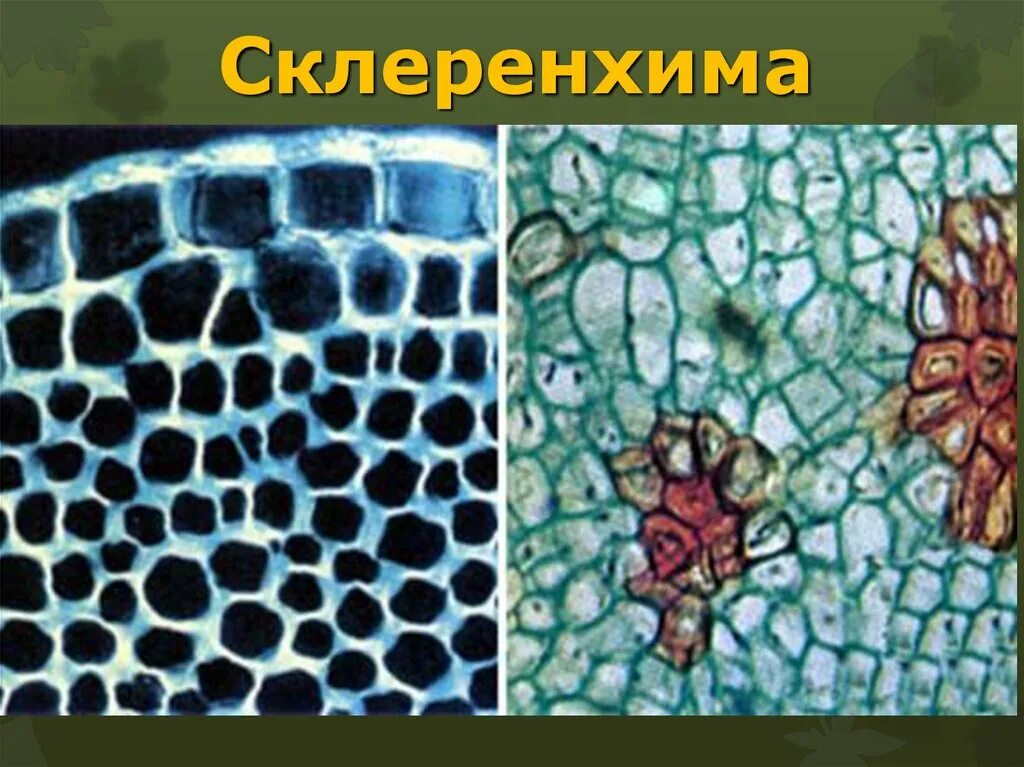 Запасающие клетки древесины
