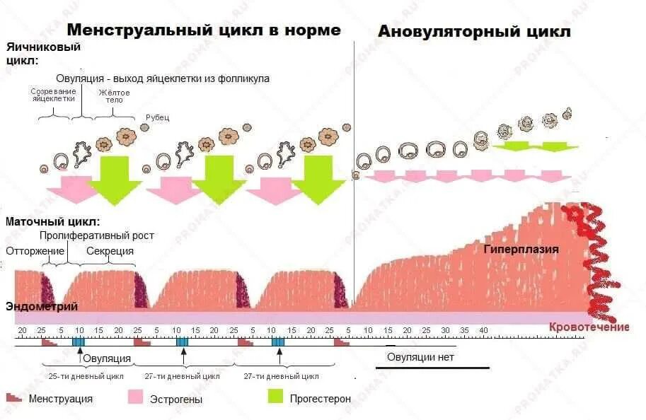 Однофазный цикл менструационного цикла. Схема ановуляторного цикла. Ановуляторный менструационный цикл схема. Ановуляторный менструационный цикл характерно. Отсутствует овуляция