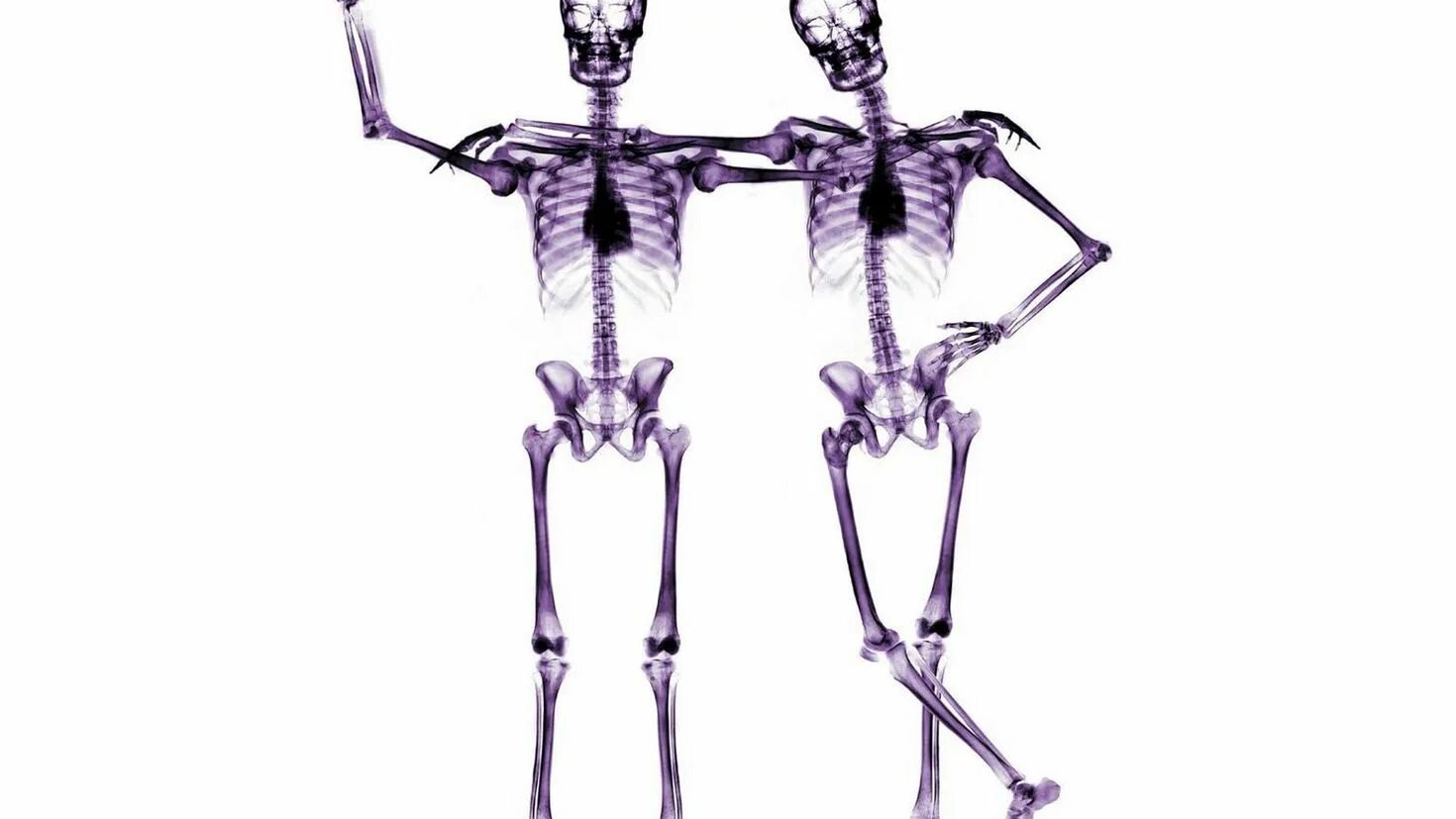 Облегченный скелет. Скелет человека. Рентгеновский снимок скелета. Скелет на белом фоне.