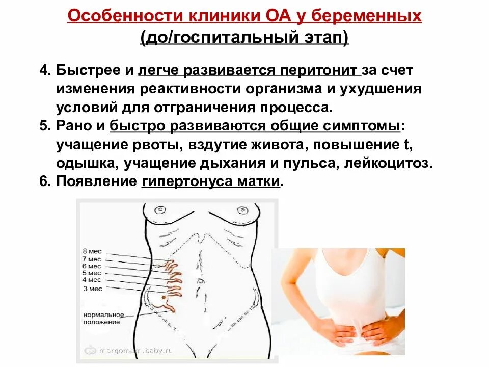 Острый гинекологический живот. Острый живот в гинекологии заболевания. Причины острого живота в гинекологии. Острый живот презентация. Острый живот и беременность.