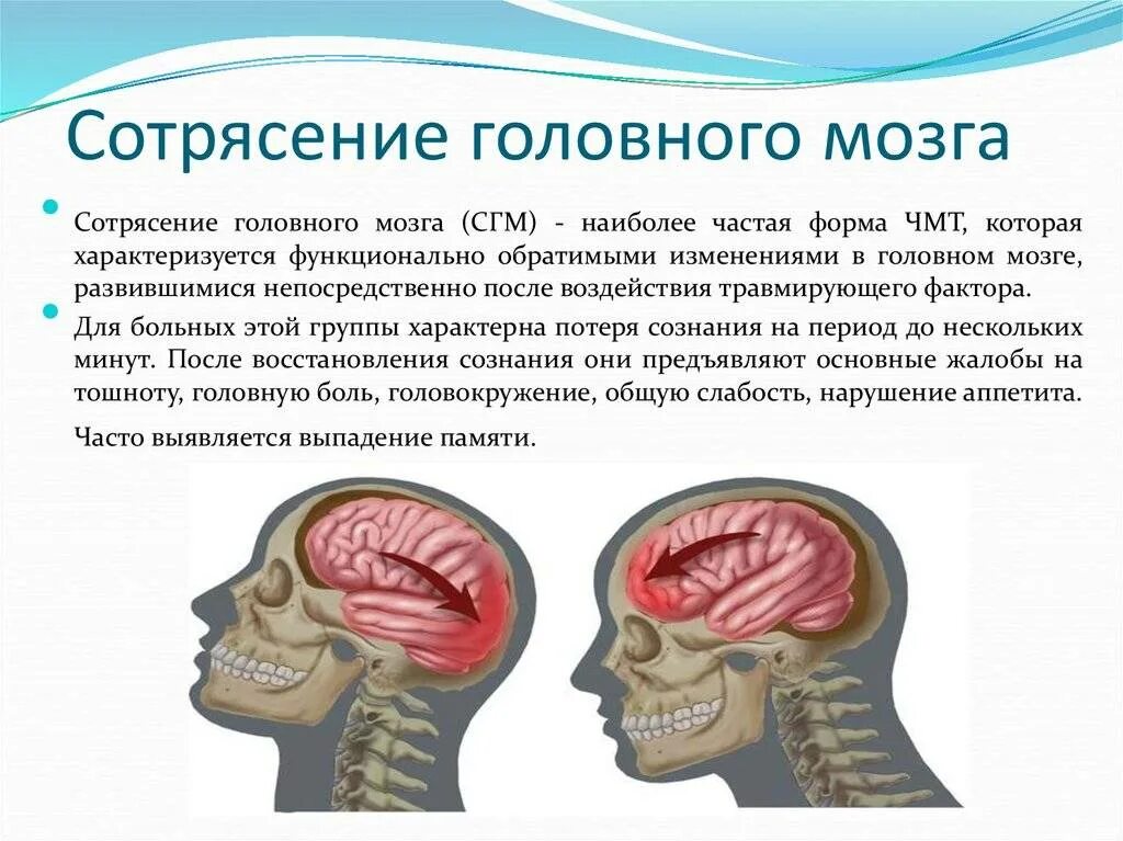 Сотрясение 1. Три основных признака при сотрясении головного мозга.. Симптомом сотрясения головного мозга является. Основной симптом тяжелого сотрясения головного мозга. Симптоматика сотрясения головного мозга обуславливается.