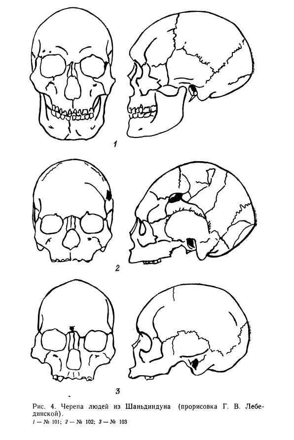 Варианты формы черепа. Долихокранная форма черепа. Брахицефальный череп человека. Формы человеческих черепов.
