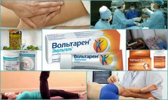 Тендиноз тазобедренного сустава что это такое. Тендинит медикаментозное лечение. Препараты при артрозе плечевого сустава. При воспалении сухожилий и связок противовоспалительные препараты. Таблетки при тендините.