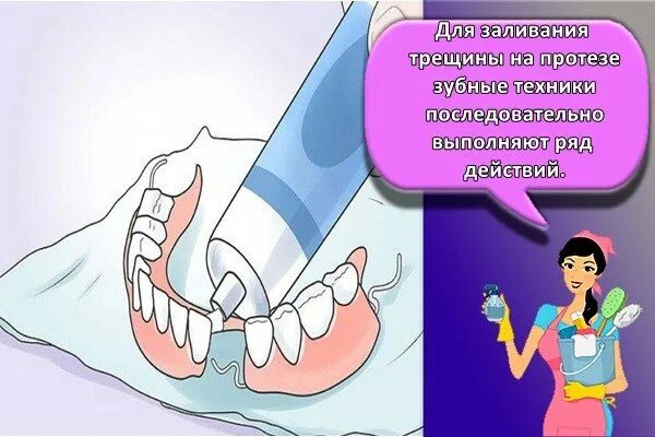 Чем можно приклеить зуб. Клей для склейки зубных. Клей для склеивания зубных протезов из пластмассы. Стоматологический клей для склеивания протезов.