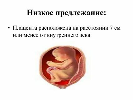 Беременность 12 недель низкая плацента