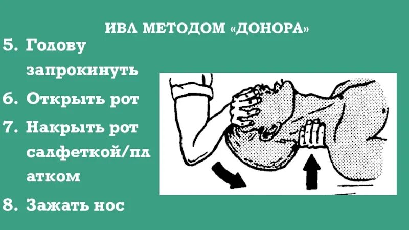 Метод донора. Искусственная вентиляция легких методом донора. Проведение ИВЛ донорским способом. Запрокинуть голову открыть рот метод. Запрокинула голову открыла рот.