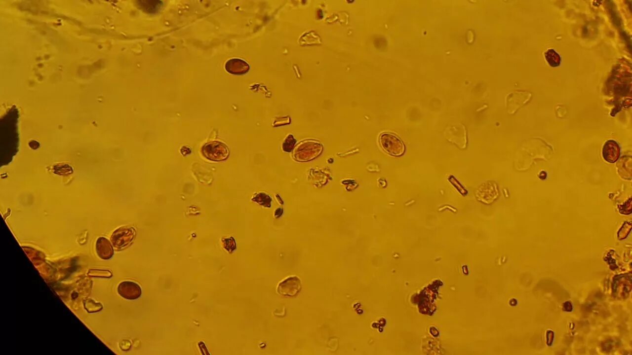 Кальтопроктеин в кале. Ооцисты лямблий микроскопия. Цисты лямблии микроскопия. Лямблии в желчи под микроскопом. Цисты лямблий микроскопия.