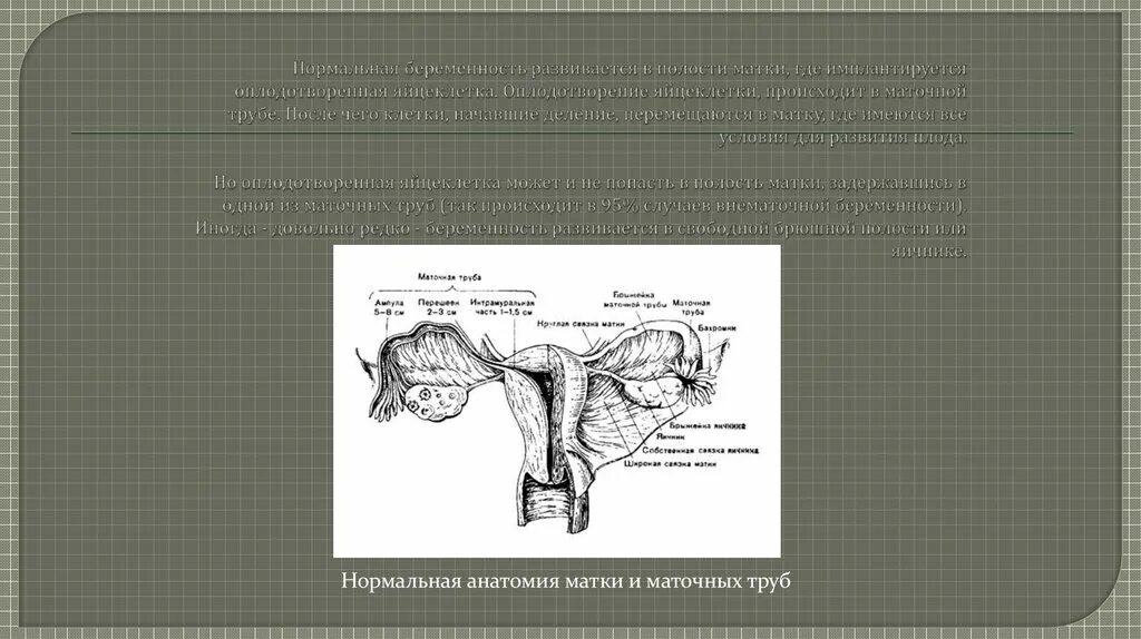 Полость матки 8. Матка анатомия. Полость матки анатомия. Маточные трубы кт анатомия.