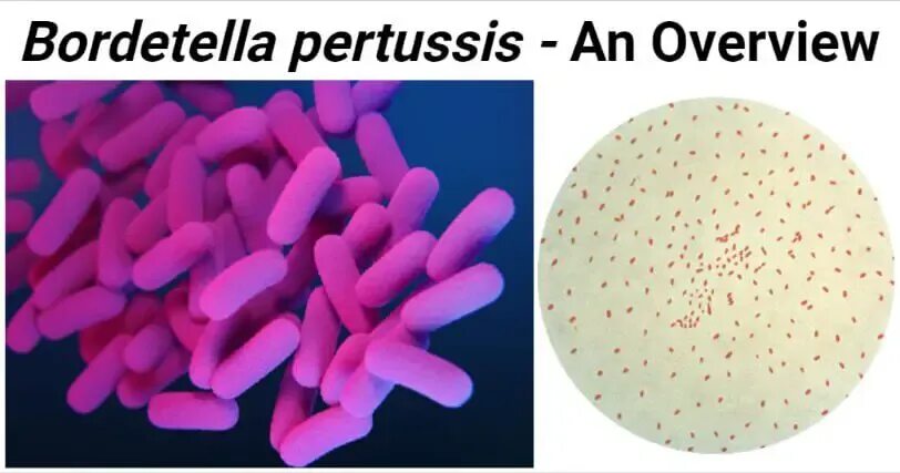 Бордетелла пертуссис. Бордетеллы микробиология. Бактерия Bordetella pertussis. Бордетеллы морфология.