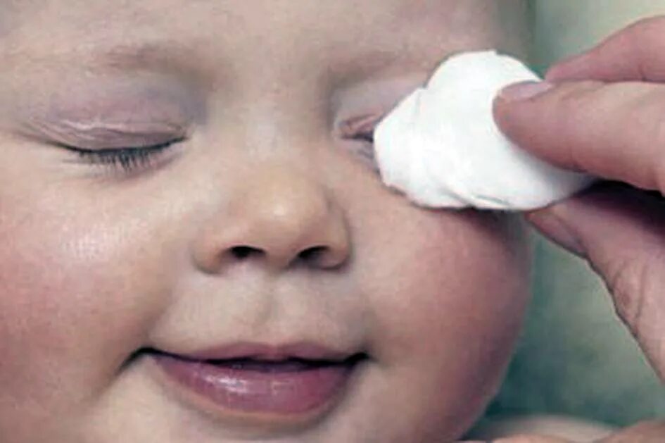 Чем обработать глаза новорожденному. Глаза новорожденного. Протирание глаз новорожденного. Умывание глаз новорожденного.