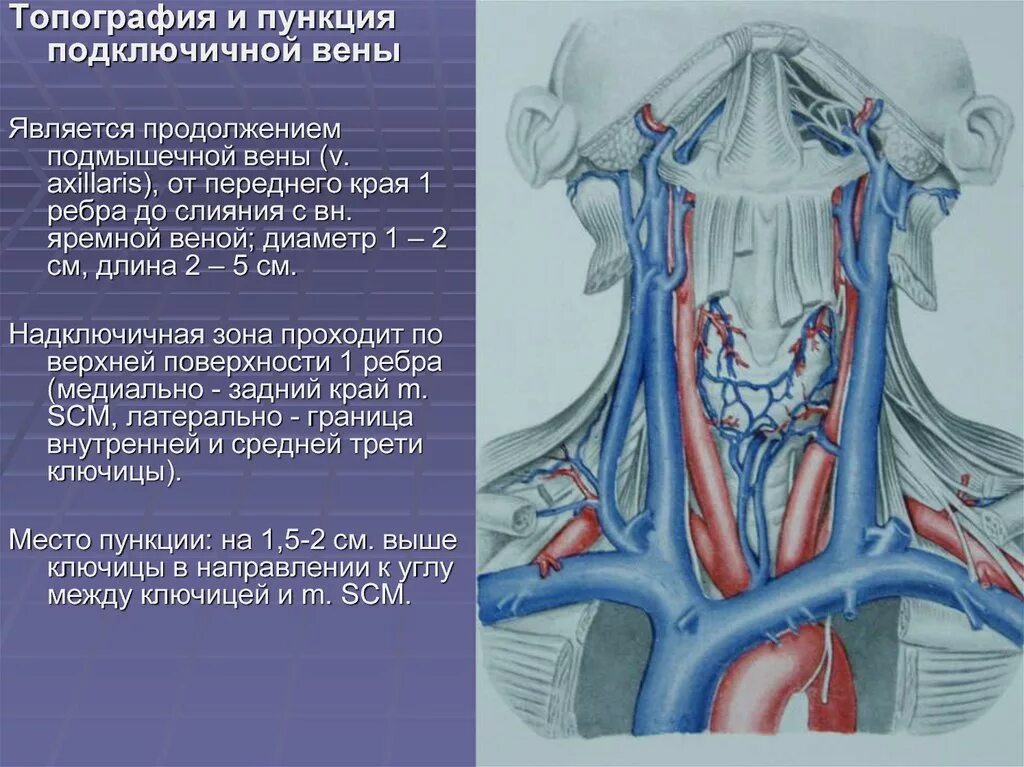 Яремная артерия где находится. Подключичная Вена (Vena subclavia). Внутренняя яремная Вена топография. Подключичная Вена топография. Внутренняя яремная Вена анатомия кт.