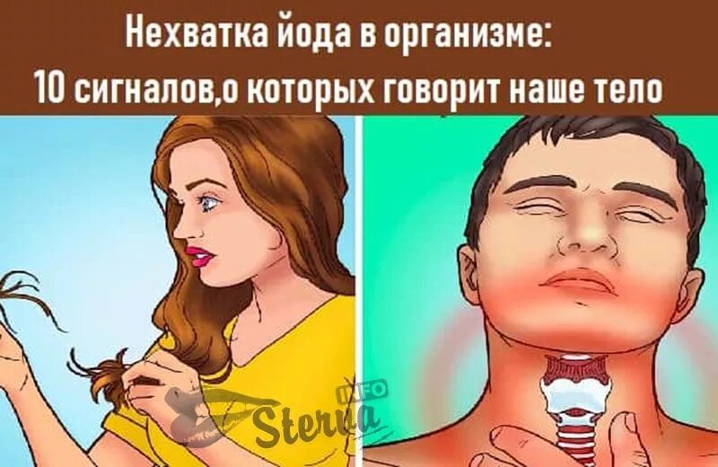 Недостаток йода в организме симптомы у женщин. Йододефицит профилактика. Дефицит йода. Проявления недостаточности йода. Дефицит йода в организме симптомы у женщин.