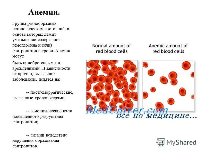 Анемия и эритроциты в крови. Анемия вследствие кровопотери. Анемия железодефицитная эритроциты в крови. Анемия эритроциты и гемоглобин. Снижены эритроциты и гемоглобин.