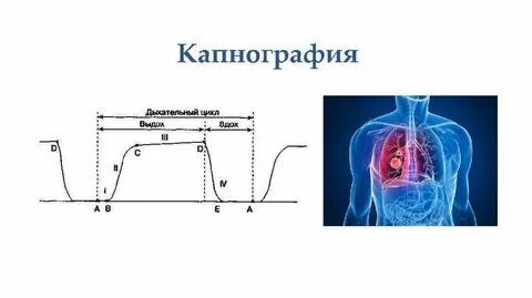 Капнография