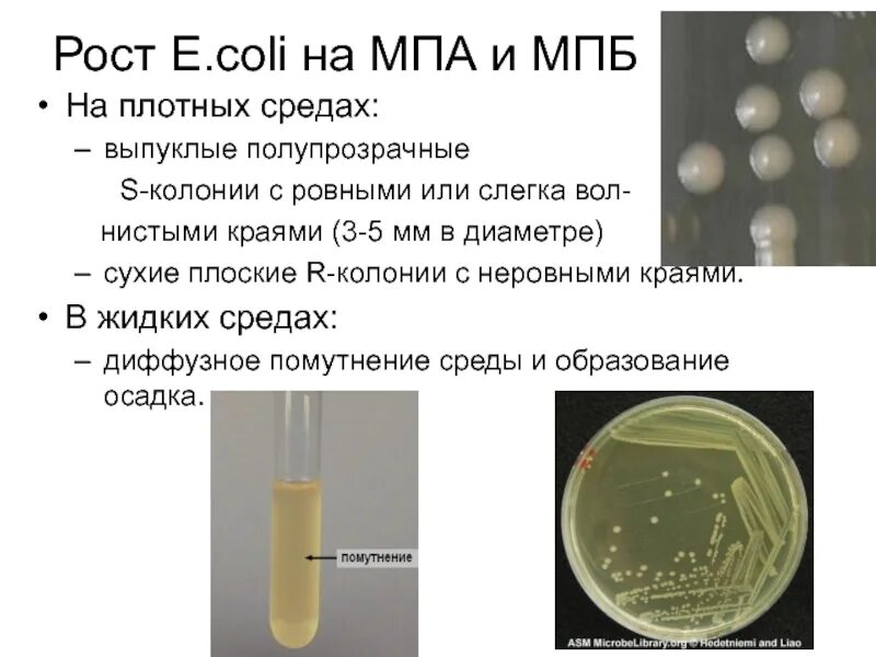 Е coli плотных питательных средах. МПБ питательная среда. МПБ микробиология. МБА среда микробиология.