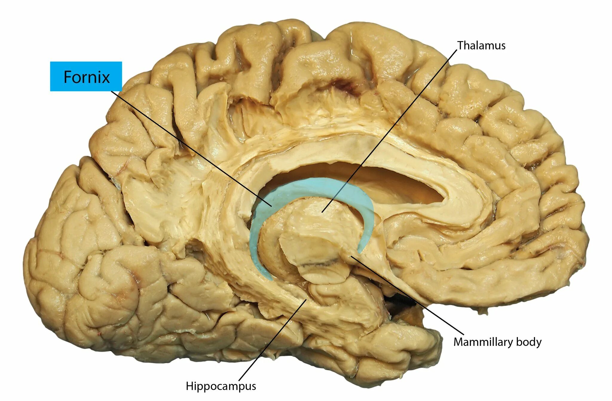 Повреждение гиппокампа. Таламус и гиппокамп. Гипоталамус таламус гиппокамп. Гиппокамп анатомия. Гиппокамп головного мозга анатомия.
