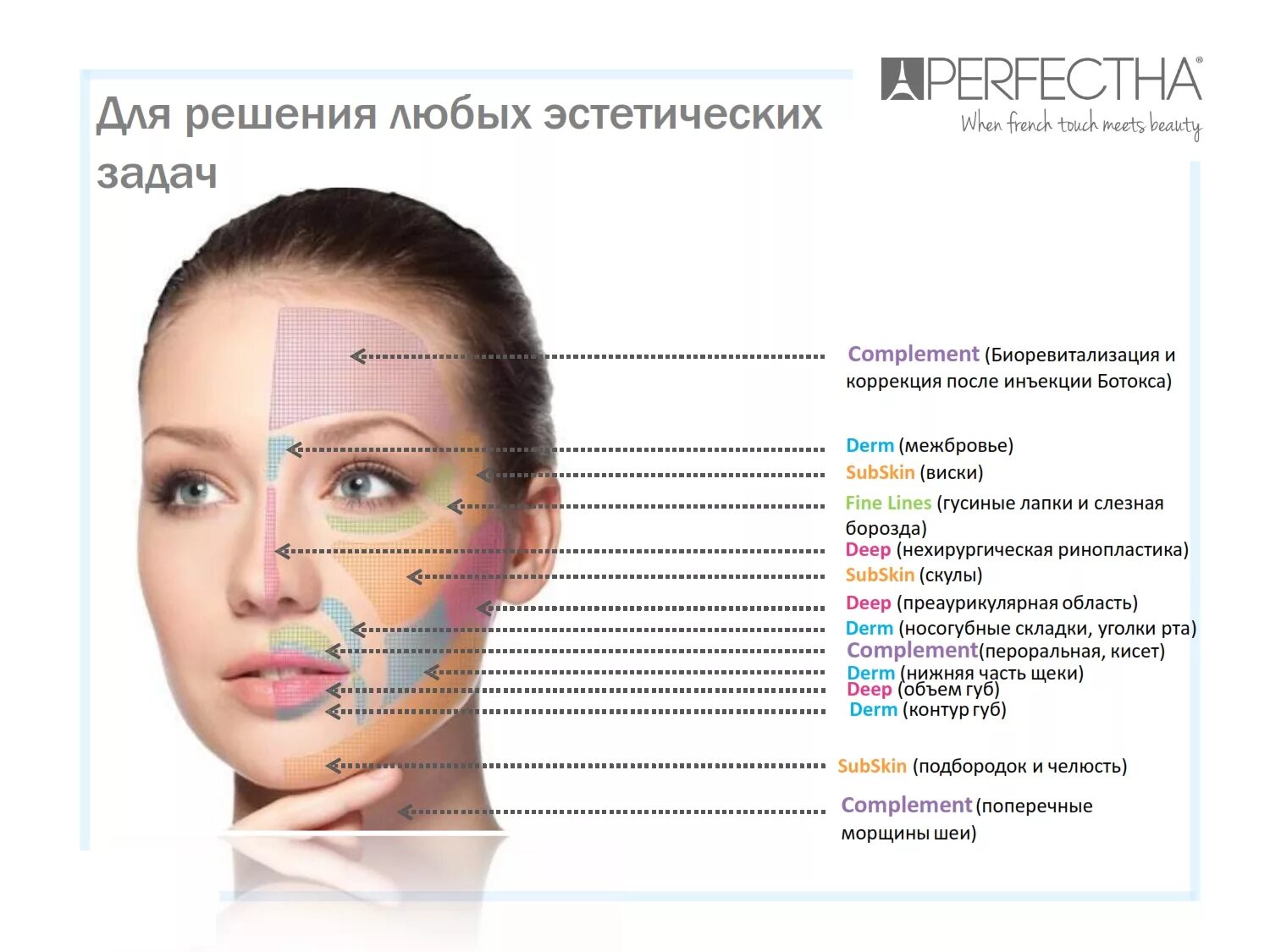 Схема введения ботокса в межбровье. Зоны введения ботокса на лице. Схема введения ботулотоксина в лоб. Схема введения ботокса на лице.