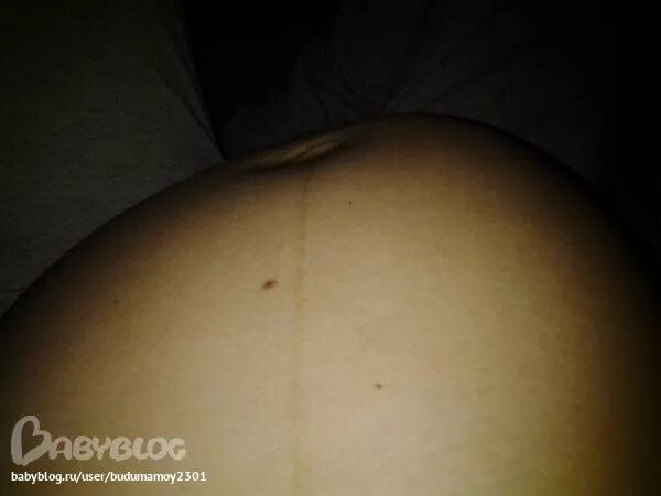 Почему напрягается живот. Живот выпячивается с одной стороны. кривой беременный живот. бугорок на животе при беременности.