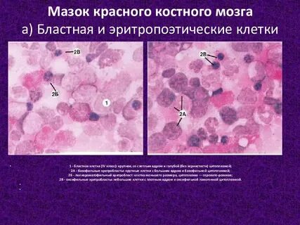 Цитологическое исследование микропрепарата
