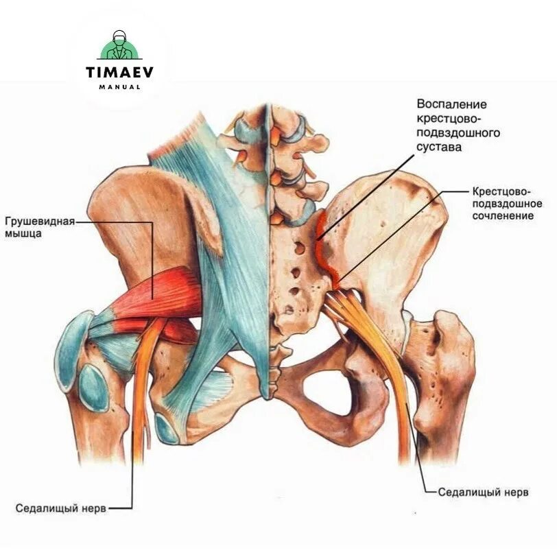 крестцово подвздошный сустав упражнения