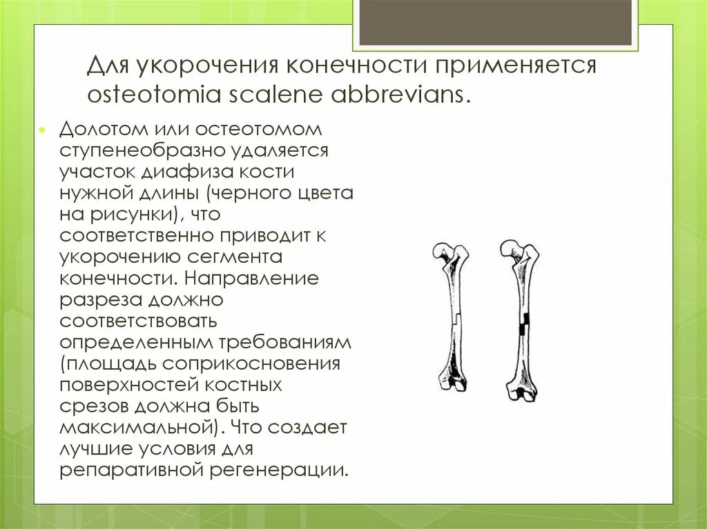 Укорочение трубчатых костей. Укорочение конечности. Укороченные трубчатые кости. Остеотомии, применяемые для укорочения конечностей.