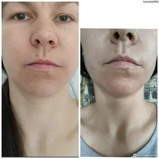 Gold osteopack отзывы