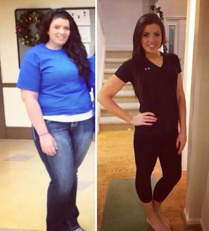 До и после похудения на 40 кг. До и после похудения девушки. Девушка похудела. До и после похудения фотосессия.