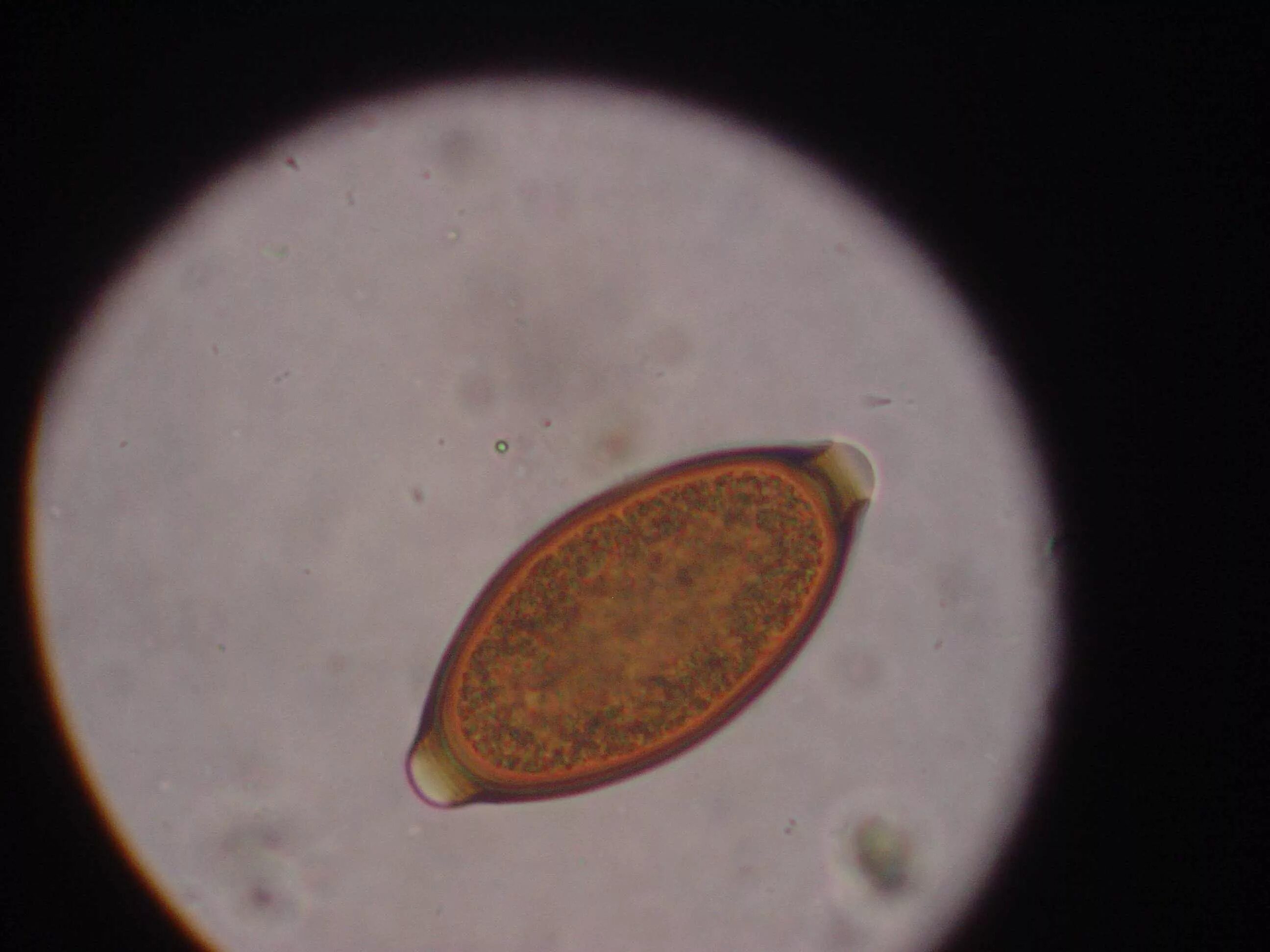 Trichuris Vulpis. Личинки паразитов трематоды. Личинки печеночный сосальщик личинки. Яйца гельминтов микроскопия. Кишечный сосальщик