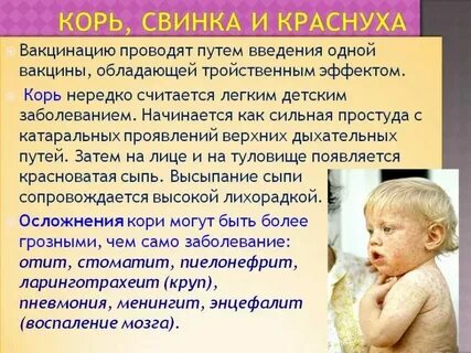 Корь свинка