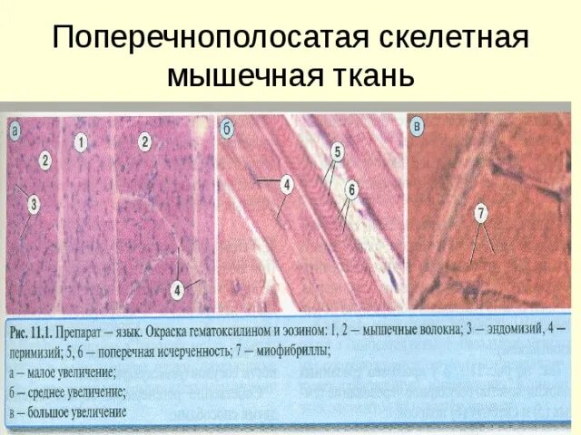 Поперечнополосатая Скелетная мышечная ткань гистология. Поперечно полосатая мышечная ткань Железный гематоксилин гистология. Поперечно полосатая Скелетная препарат. Скелетная мышечная ткань гистология. Препарат поперечно полосатая мышечная ткань