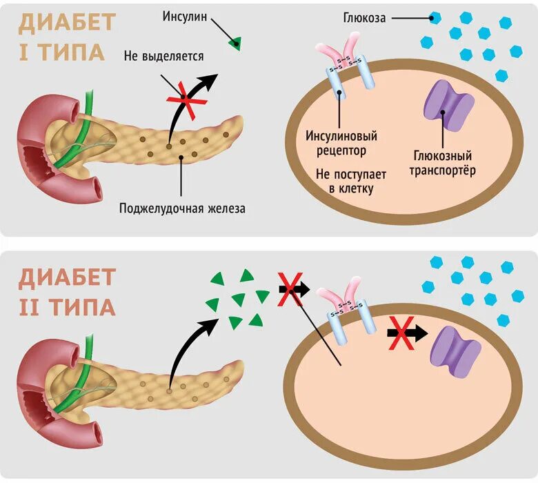 Сахарный диабет задания. Выработка инсулина поджелудочной железой схема. Сахарный диабет поджелудочная железа. Гормон поджелудочной железы инсулин функции. Поджелудочная железа вырабатывает инсулин.