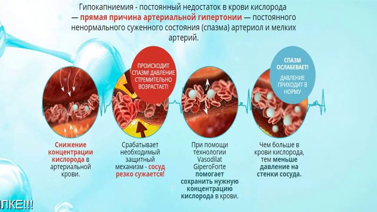 Гипертония навсегда. Гипертония. Гипертония картинки. Гипертония высокое давление лечить легко и навсегда. Профилактика гипертонии.