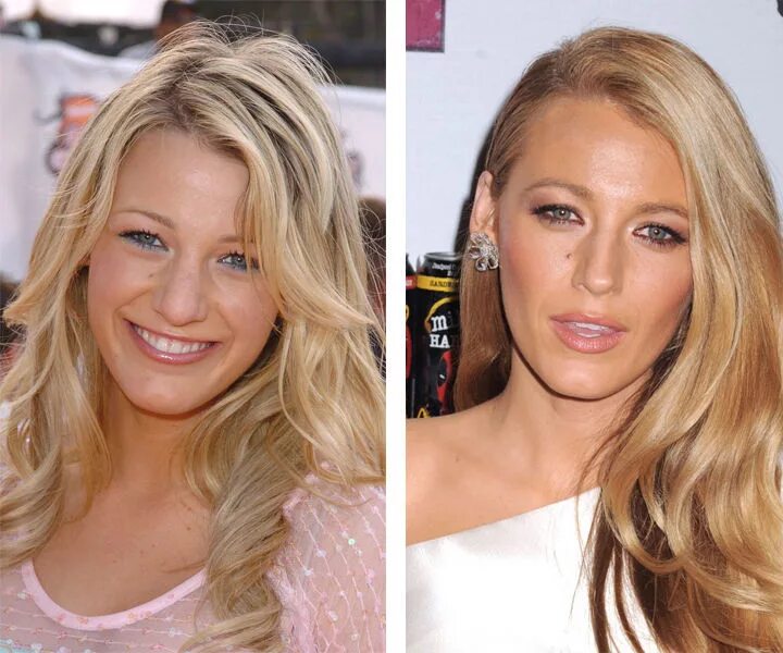 Блейк лайвли до пластики. Блейк лайвли до и после операции. Блейк лайвли до увеличения груди. Блейк лайвли нос. Блейк лайвли ринопластика.