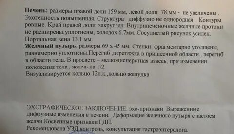 Заключение эхо