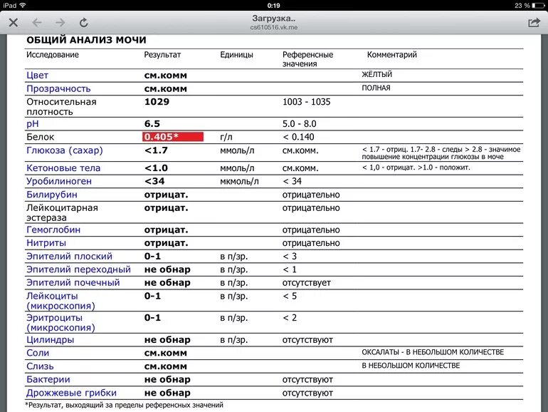 ОАМ уробилиноген норма. Анализ белка в моче норма. Общий анализ белка в моче при беременности норма. Белок в моче 0.3 г/л. Почему в моче белок причины