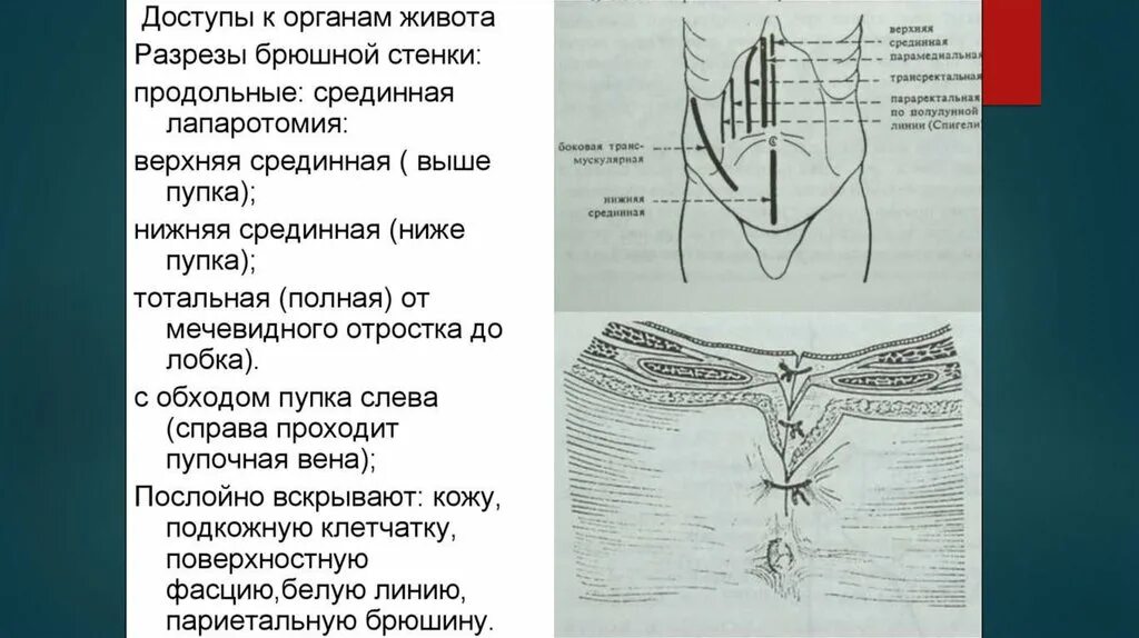 Брюшная стенка после операции. Лапаротомия топографическая анатомия. Верхняя срединная лапаротомия шов. Срединные лапаротомии: верхняя, средняя, нижняя. Лапаротомные разрезы на вентральной брюшной стенки.