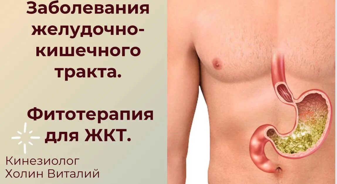 Тесты заболевания желудка. Заболевания желудочно-кишечного тракта. Фитотерапия заболеваний желудочно-кишечного тракта. Фитотерапия при заболеваниях желудочно-кишечного тракта. Синдром перекреста ЖКТ.