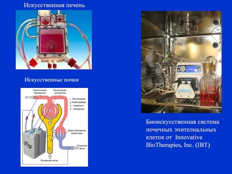 Искусственная биологическая система. Искусственная печень аппарат. Биоискусственная печень искусственная печень. Тканевая инженерия печени. Аппарат искусственная почка.