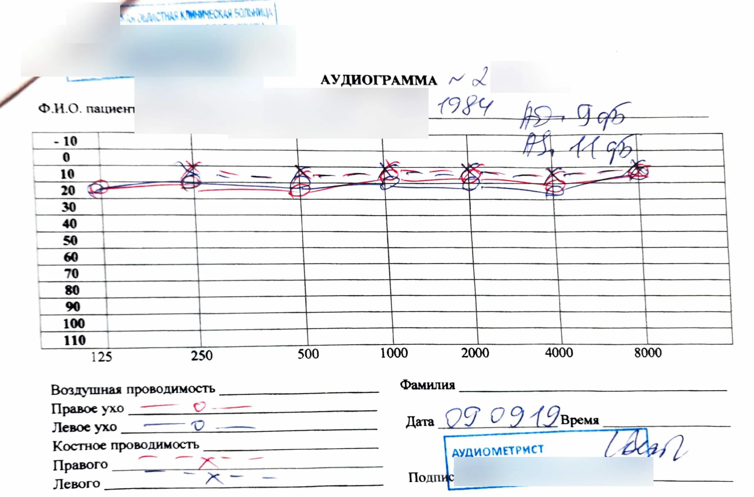 Аудиограмма слуха норма костная проводимость. Аудиограмма слуха норма график. Аудиограмма слуха расшифровка таблица. Норма аудиограммы для правого и левого уха. Аудиограмма норма