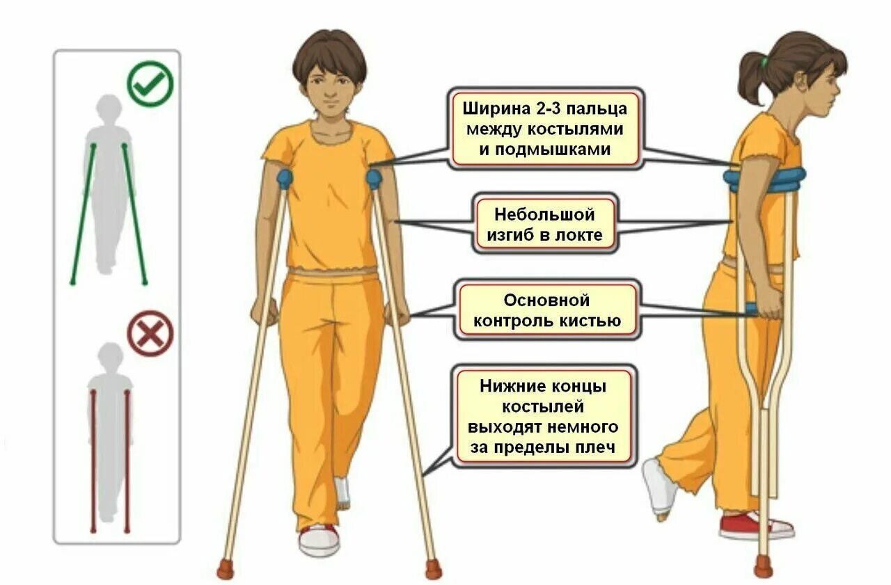Как правильно подобрать костыли. Подобрать костыли. Подобрать костыли по росту. Правильная регулировка костылей. Правильная высота костылей.