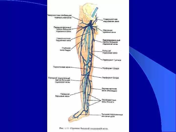 Суральные вены голени тромбоз. Медиальные суральные вены. Суральная Вена нижних конечностей тромбоз.