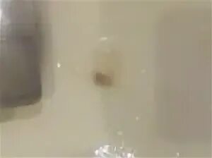 Желтая мокрота температура