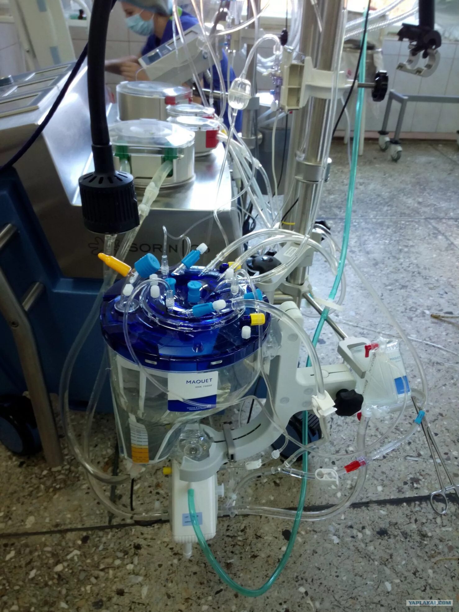 Перфузиолог. Аппарат искусственного кровообращения. Анестезиолог-перфузиолог. Лаборатория искусственного кровообращения. Перфузиолог.