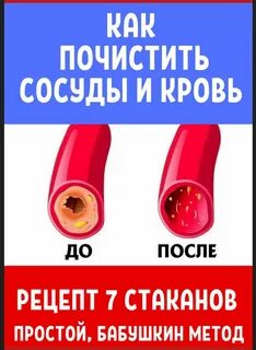 Как почистить сосуды