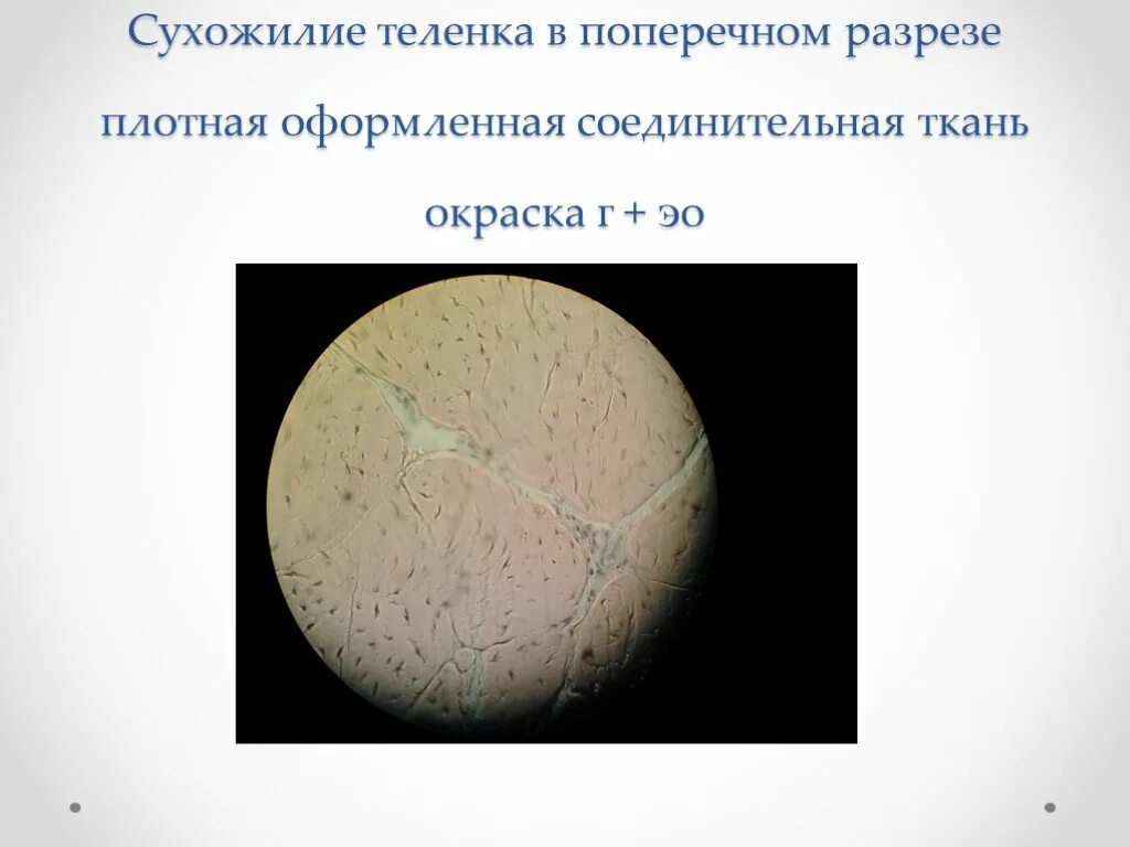 Срез сухожилия