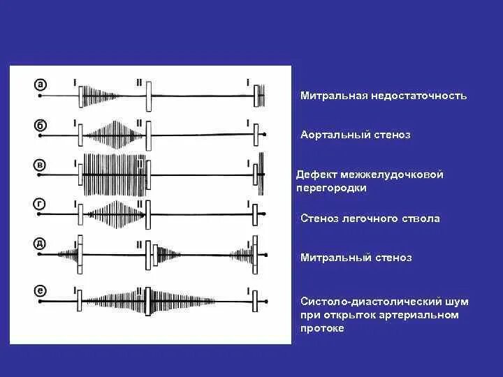 Аускультативная картина. Аускультативная картина
