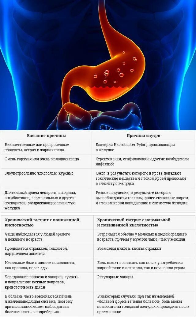 Форум боли гастрита. Симптомы снижения кислотности желудочного сока. Гастрит повышенная кислотность. Острый гастрит и хронический гастрит таблица. Повышающие и понижающие кислотность желудка.