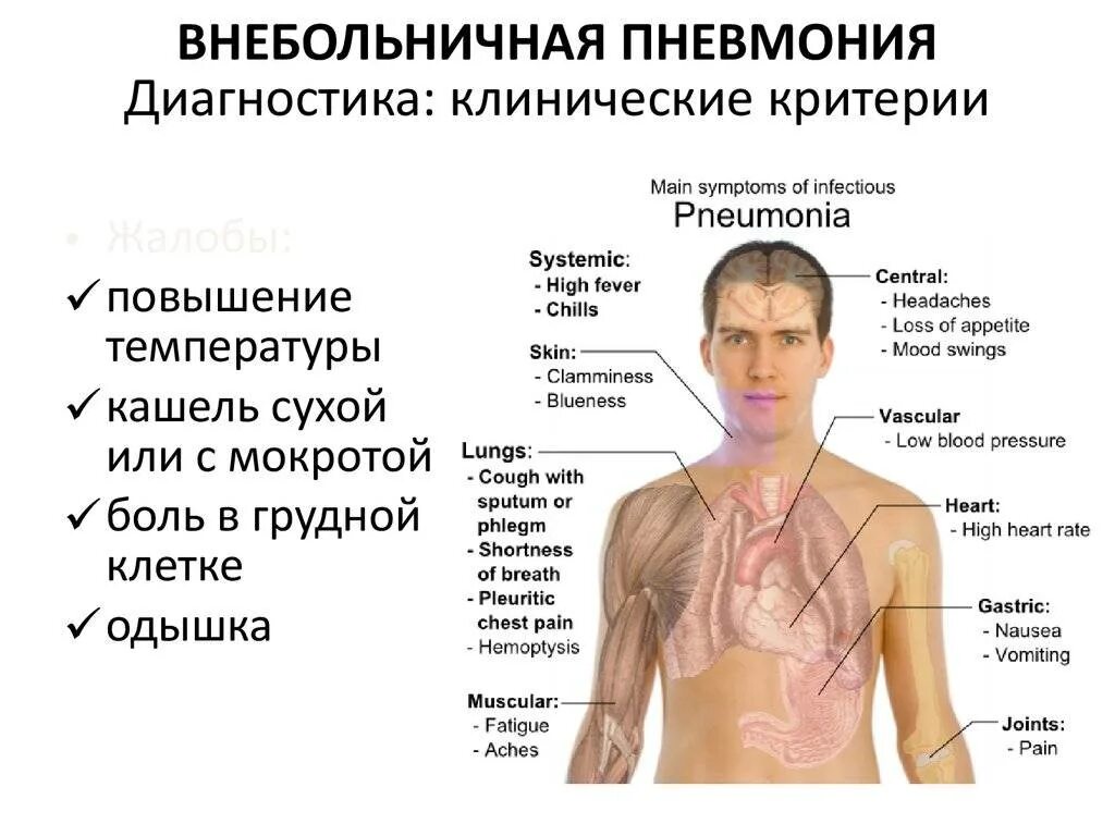 При воспалении легких какие симптомы у взрослых. Пневмония симптомы внебольничной пневмонии. Локализация боли при пневмонии. Боль в грудной клетке. Боль и дискомфорт в грудной клетке.