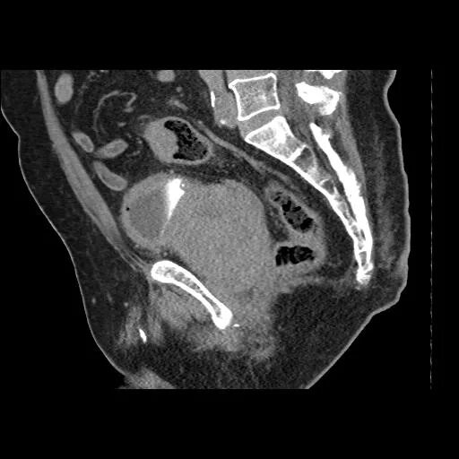 кт с контрастом малого таза у мужчин. кт с контрастом малого таза у мужчин. кт с контрастом малого таза у мужчин. мрт малого таза с контрастированием подготовка. кт с контрастом малого таза у мужчин.