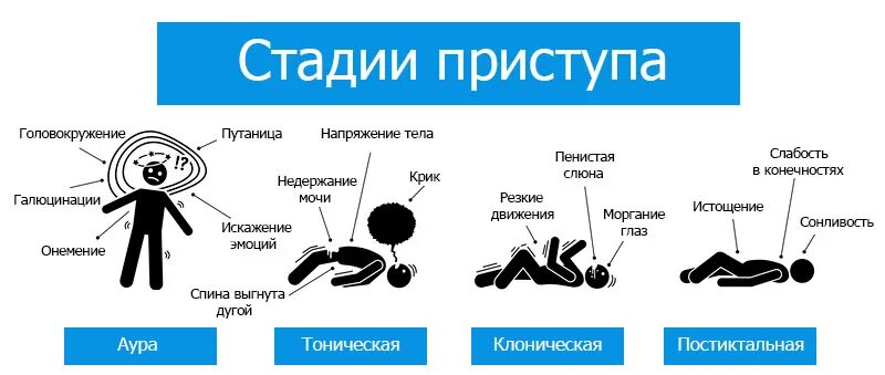 Фазы приступа эпилепсии. Стадии эпилептического припадка. Приступ эпилепсии стадии. Фазы эпилептического приступа. Стадии эпилепсии